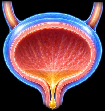 Urinary Incontinence
