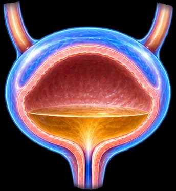 Neurogenic Bladder